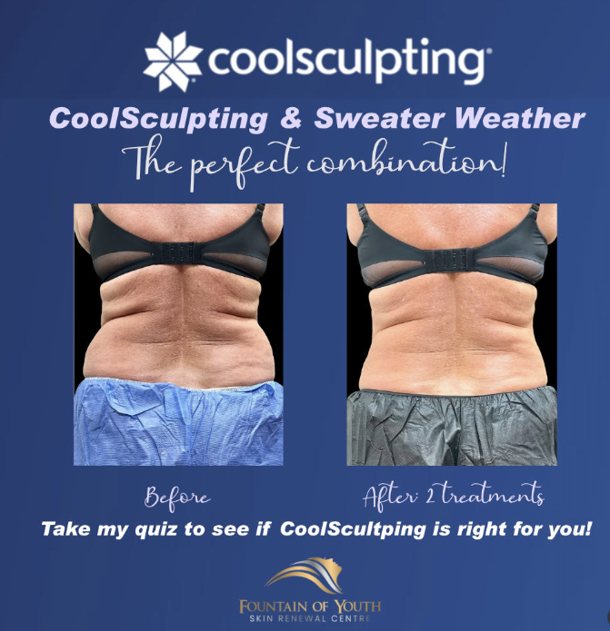 coolsculpting